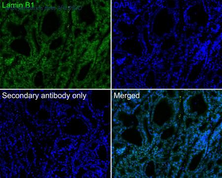 HUABIO HA720171F image 1