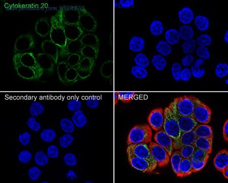 HUABIO HA720189F image 1