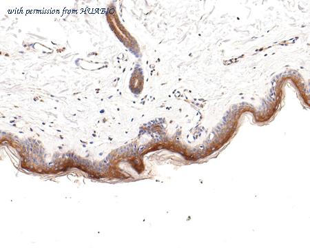 HUABIO HA721004 image 3