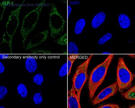 HUABIO HA721009 image 3