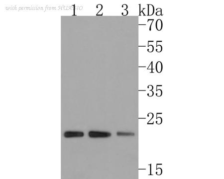 HUABIO HA721015 image 1