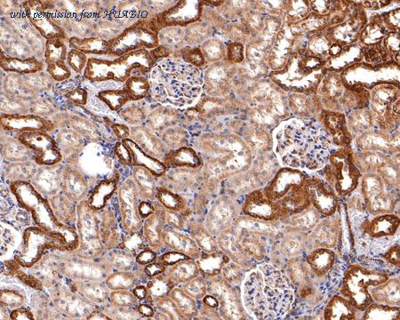 HUABIO HA721015 image 3