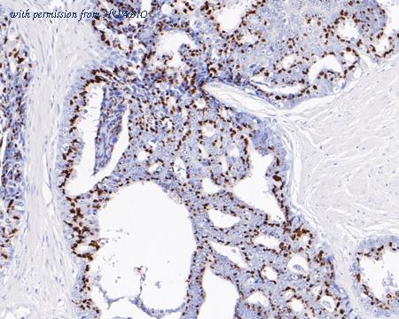 HUABIO HA721018 image 2