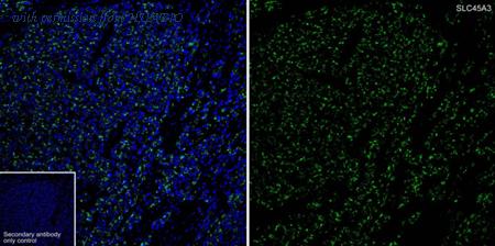 HUABIO HA721018 image 3