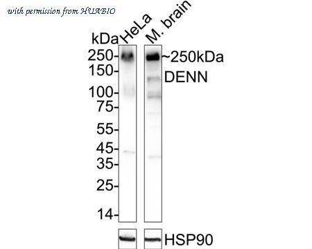 HUABIO HA721022 image 1