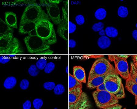 HUABIO HA721042 image 3