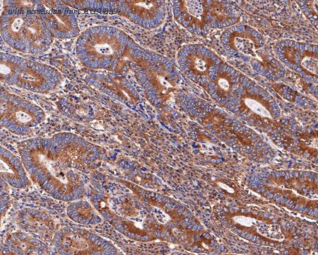 HUABIO HA721050 image 3