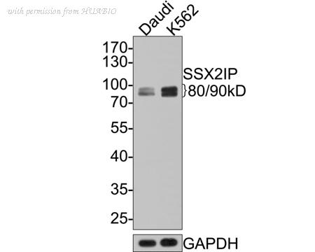 HUABIO HA721065 image 1