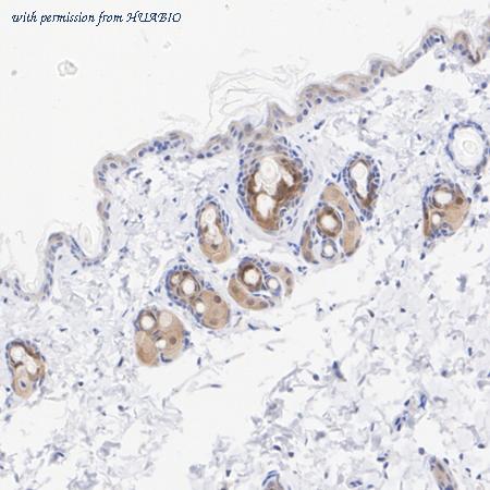 HUABIO HA721070 image 3