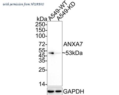 HUABIO HA721078 image 1