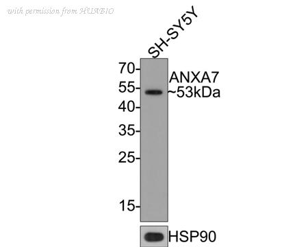 HUABIO HA721078 image 2