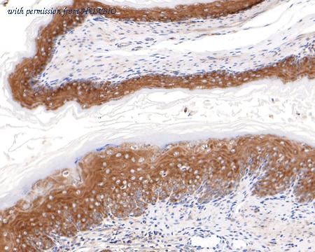 HUABIO HA721098 image 3