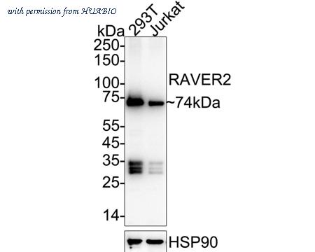 HUABIO HA721100 image 1