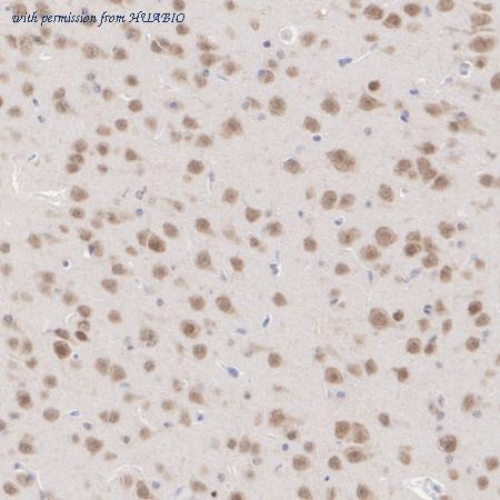 HUABIO HA721109 image 3