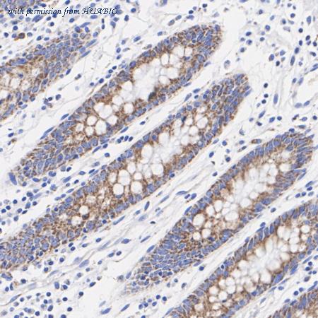 HUABIO HA721120 image 3