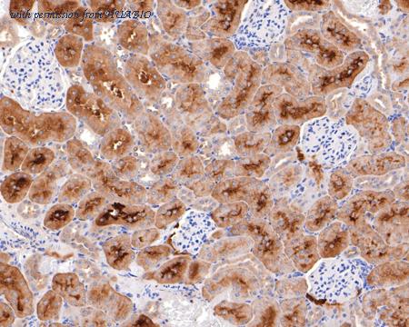 HUABIO HA721122 image 2