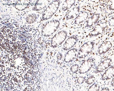 HUABIO HA721125 image 3