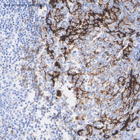 HUABIO HA721139 image 1