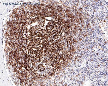 HUABIO HA721139 image 2