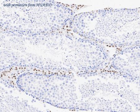 HUABIO HA721156-50UL image 3