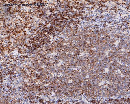 HUABIO HA721157 image 2