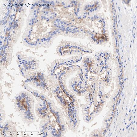 HUABIO HA721158 image 2