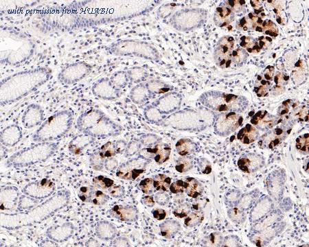 HUABIO HA721159 image 1