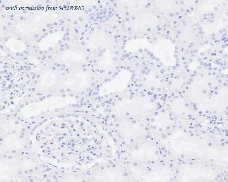 HUABIO HA721159 image 2