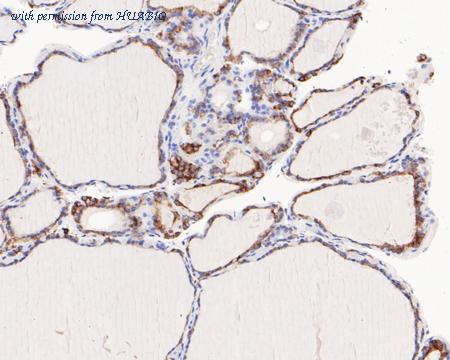 HUABIO HA721173 image 1