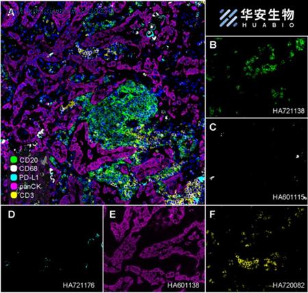 HUABIO HA721176 image 1