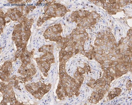 HUABIO HA721179 image 2