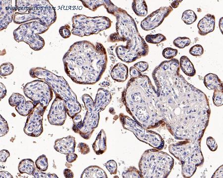 HUABIO HA721188 image 2