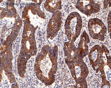 HUABIO HA721196 image 1