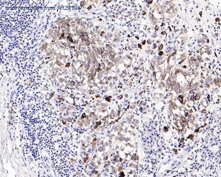 HUABIO HA721197 image 2