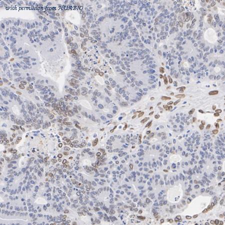 HUABIO HA721198 image 2