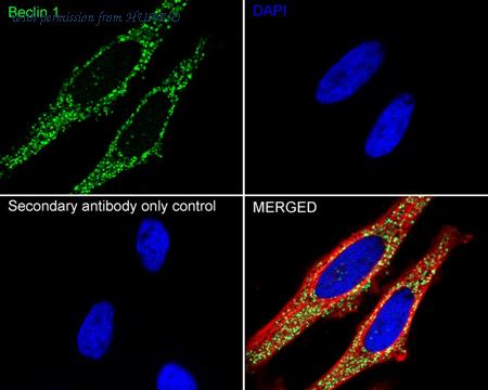 HUABIO HA721216 image 2