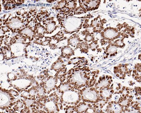 HUABIO HA721223-50UL image 2