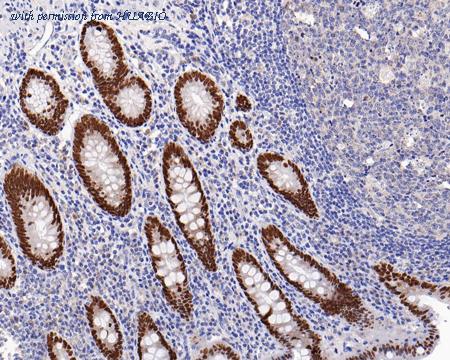 HUABIO HA721223-50UL image 3