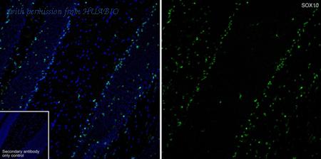 HUABIO HA721240 image 1