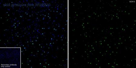 HUABIO HA721240 image 2