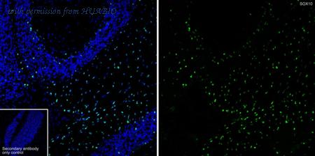 HUABIO HA721240 image 3