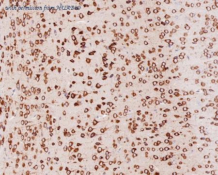 HUABIO HA721302 image 3