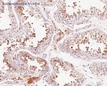 HUABIO HA721309 image 2