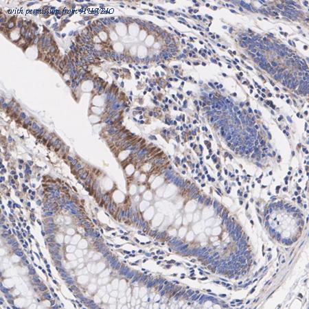 HUABIO HA721310 image 2