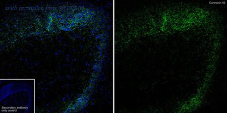 HUABIO HA721312 image 2