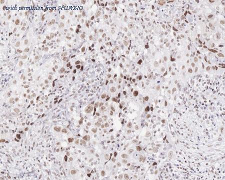 HUABIO HA721313 image 3