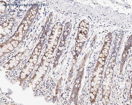 HUABIO HA721314 image 2