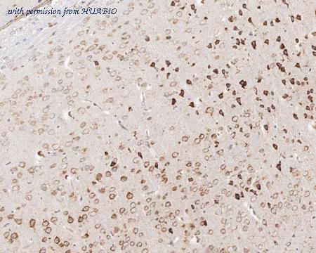 HUABIO HA721314 image 3