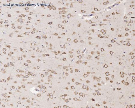 HUABIO HA721315 image 3