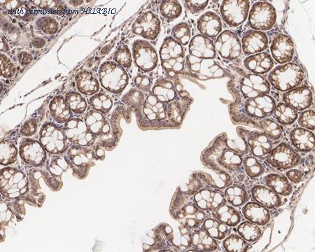 HUABIO HA721328 image 3